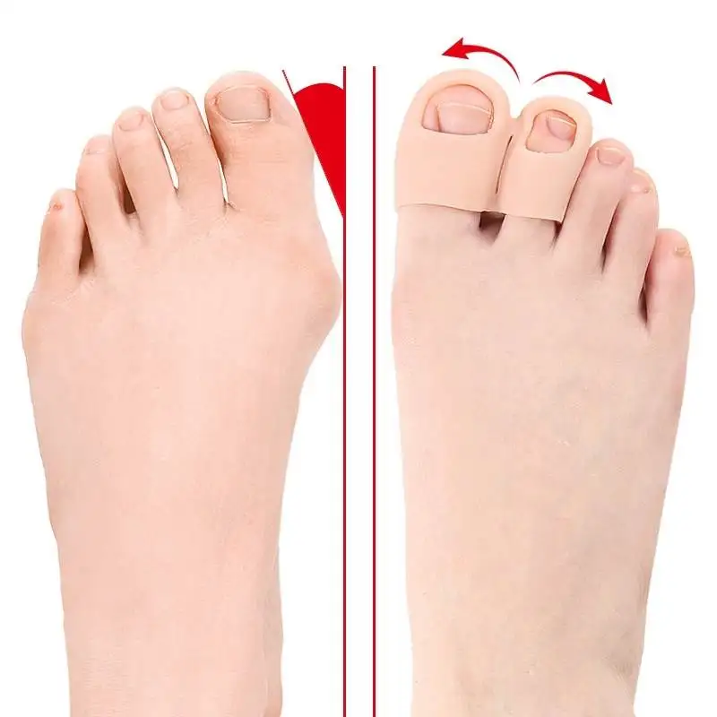 1/2Pairs Toe Separator Hammer Toe Corrector Bunion Protector Silicone Gel Bunion Protector Bunion Protector Fingers Splint 3