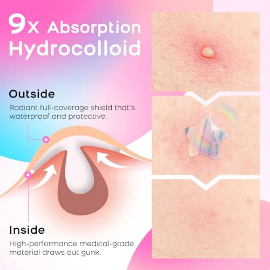 Pimple Patches for Face Cute Hydrocolloid Acne Patches Colorful Hologram Star Sport Stickers Zits Blemish Pimple Patch with Sal