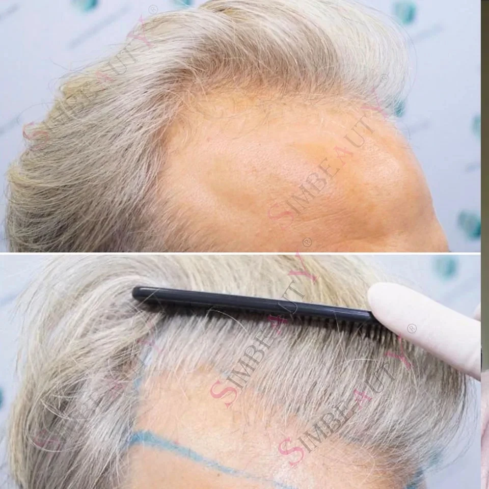 

Супертонкая основа 0.02мм, 1B80 1B65, серые человеческие волосы, 80-90% плотность, натуральная линия роста волос, накладные пряди V-образной формы, мужской парик-накладка на коже головы