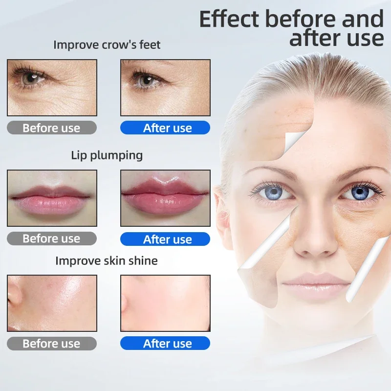 0.3ML 0.5ML Disposable Ampoule Head Cartridge For Hyaluron Pen Mesotherapy Hyaluronic Acid Pen Anti Wrinkle Lip Injection