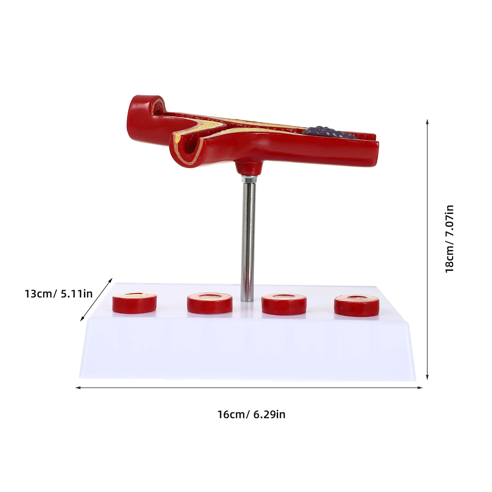 Cardiovascular Atherosclerosis PVC Realistic Blood Vessel Display Teaching Hospital Atherosclerosis Anatomical Show