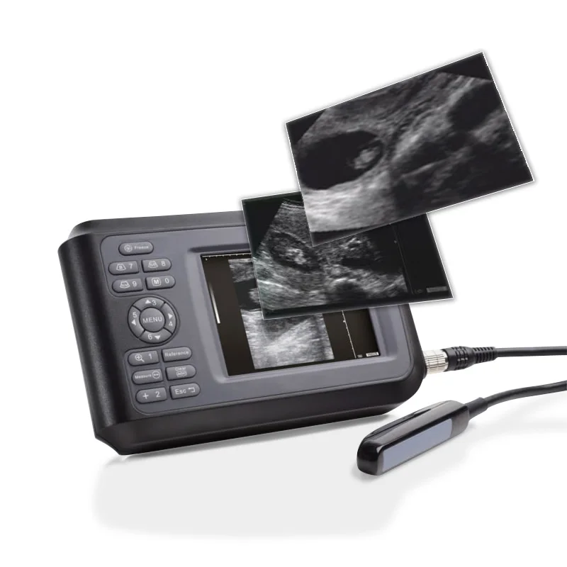 Full Digital Ultrasonic Diagnostic Instrument Veterinary Ultrasound Machine Pet Ultrasound Machine