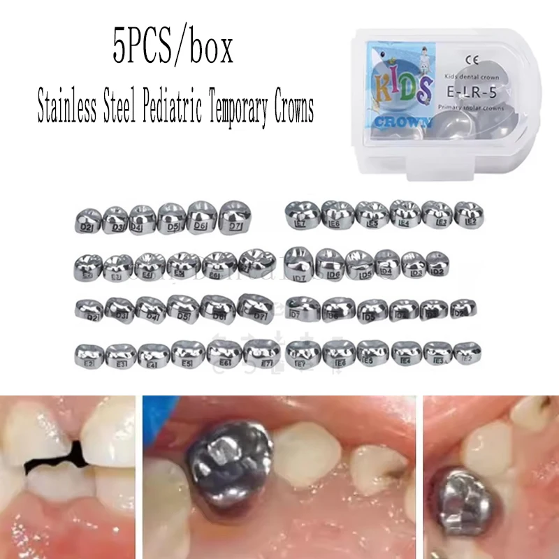 5Pcs/Box Stainless Steel Dental Kids Primary Molar Crowns Stainless Steel Preformed Crown for 1st 2nd Upper Crowns Therapy