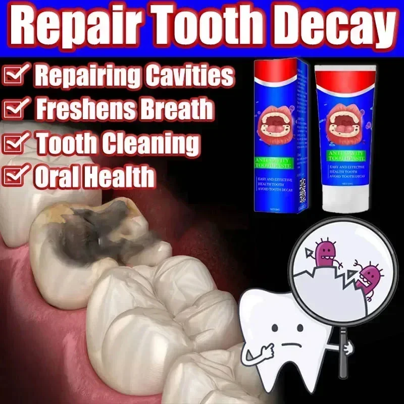 

Cavity anti-cavities toothpaste Teeth whitening bad breath Repair cavities Remove plaque Toothache relives periodontitis