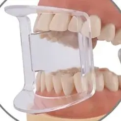 

10 шт., открывалка для рта, стоматологический ортодонтический расширитель для губ, щек, расширитель, стоматологический аксессуар для рта для передних зубов, задние зубы