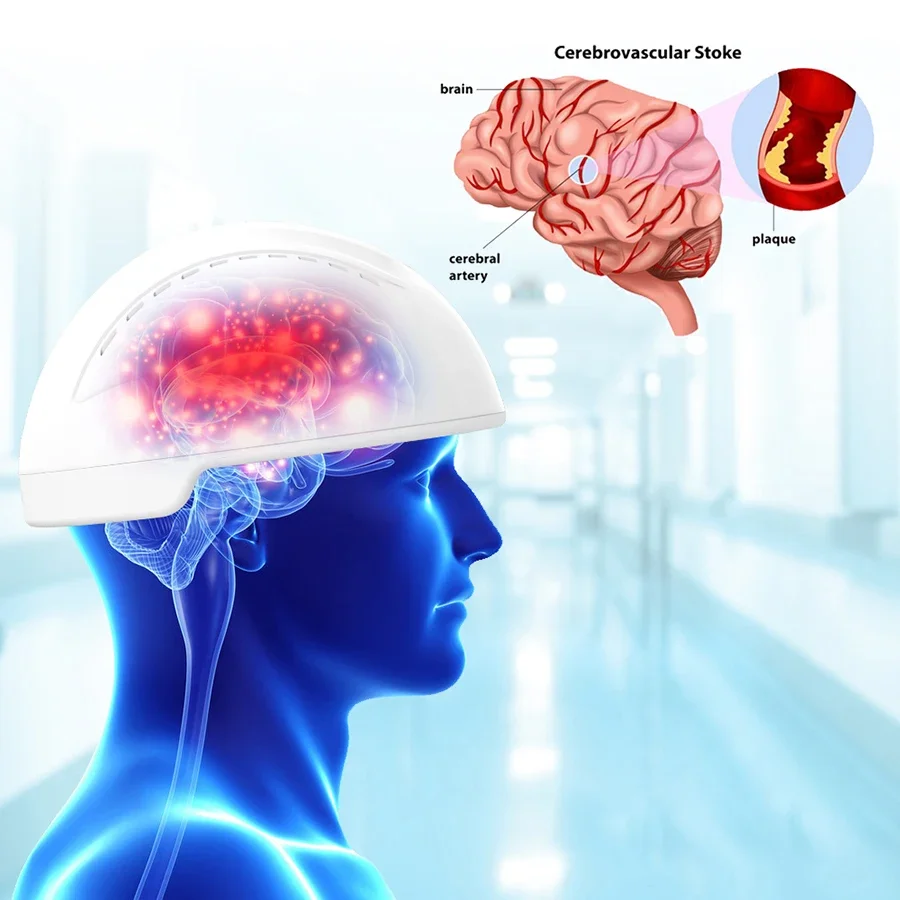 Neurofeedback Devices Brain Disease Treatment Photobiomodulation Helmet for Stroke