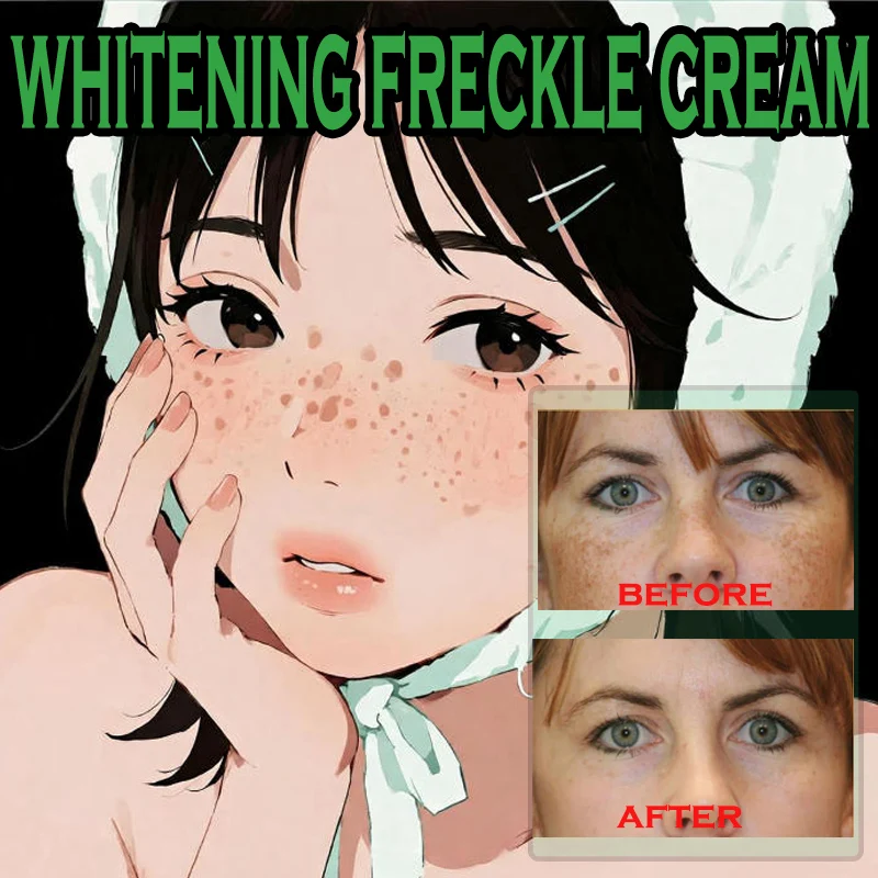 

EELHOE Nicotinamide Freckles Cream Moisturizing Face Lightening Repair Skin Care Melasma Remover Pigmentation Removal Cream