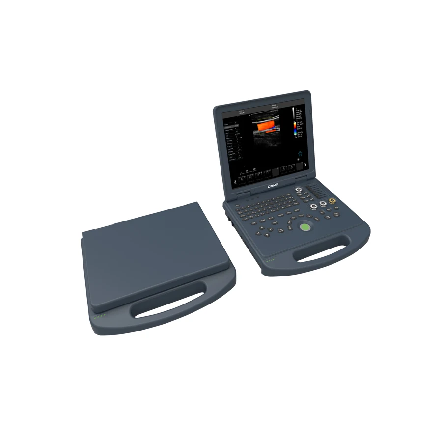 Economic and Reliable Trolley full digital color doppler ultrasound machine