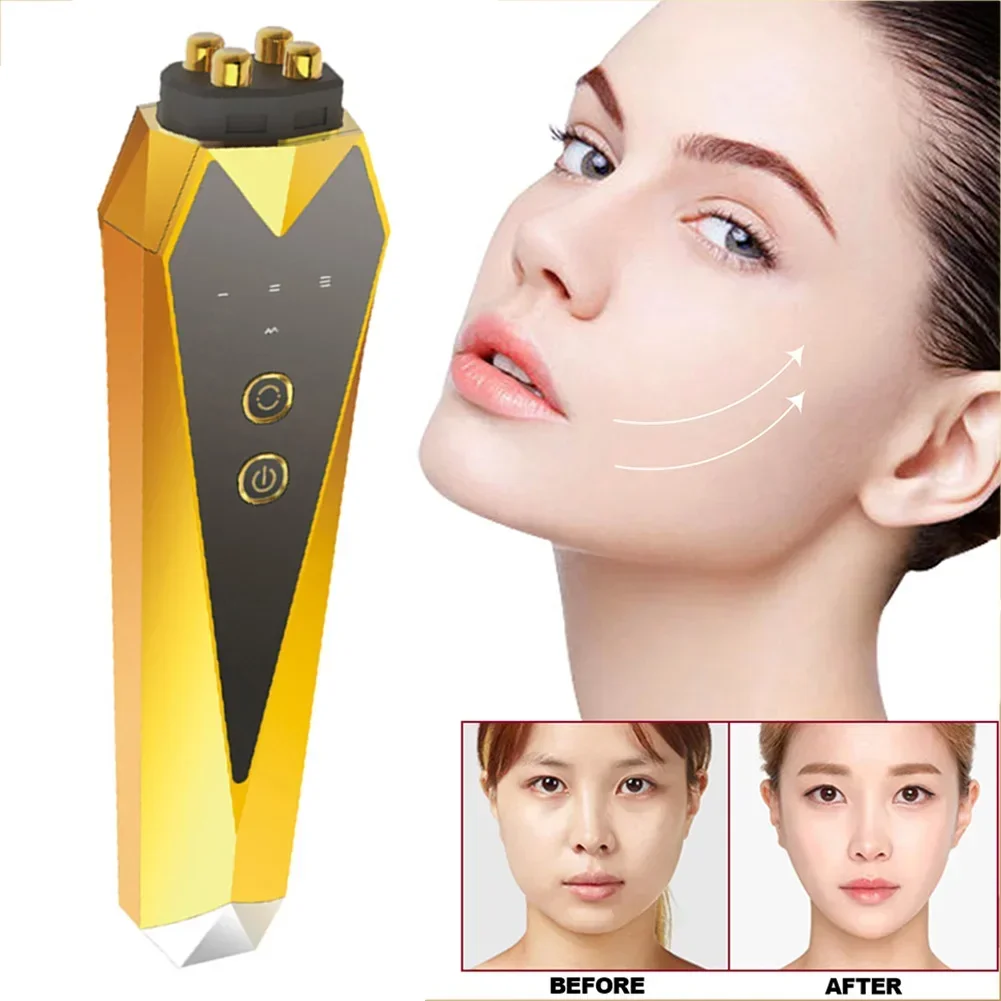 RF Radio Frequency Instrument Eye Massage Instrument Wrinkle Removal EMS Beauty Instrument Anti-aging Collagen Activation Makeup