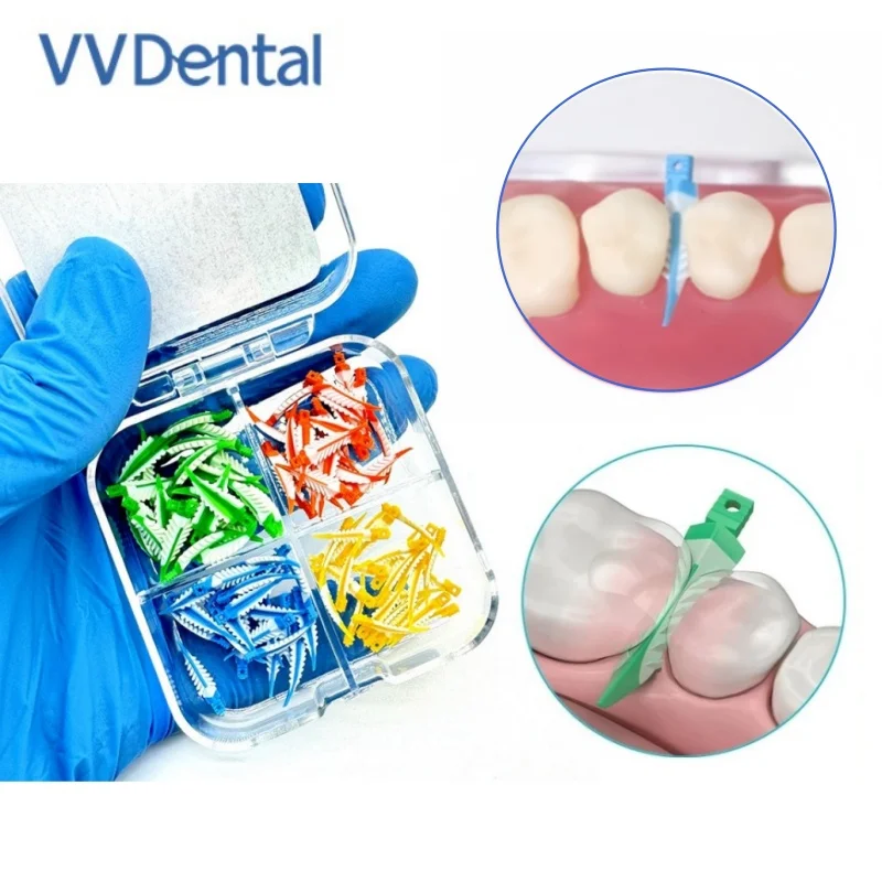 

New Dental Interdental Wedges 270° Sealing Composite Wedges Silicone Suitable Adaptive Dentist Material for Tooth Restoration