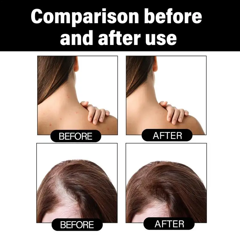 Minyak penumbuh rambut 30ml, minyak esensi penumbuh rambut, Losion Esens penutrisi kulit kepala untuk memperkuat rambut menipis