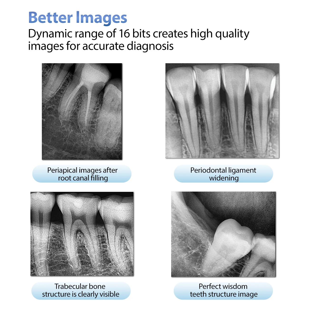 2-jähriger Garantie-Dentalsensor mit Halter, schnellere, langlebige USB-Dental-Röntgensensor, intraorale Kamera, digitaler RVG-Sensor