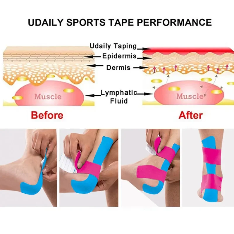 Kinesiology Tape Sport Athletics Elastic Knee Brace Support Elbow Protector Pad Volleyball Bandage Fixer Tape Wristbands Bandag