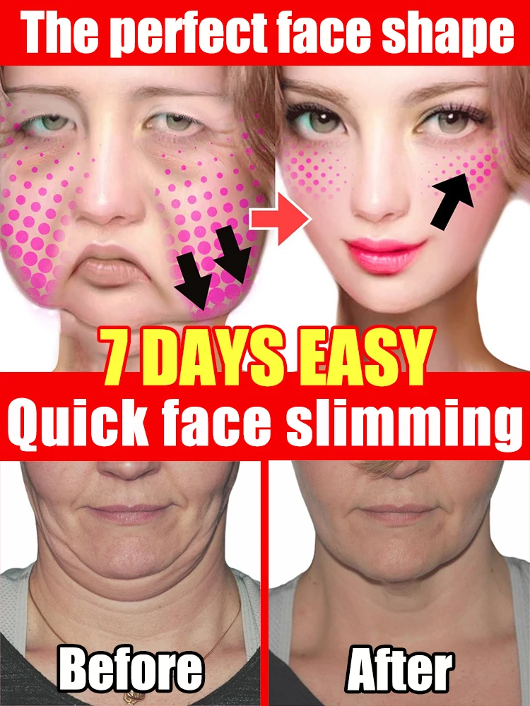 

V face cream double chin elimination V line