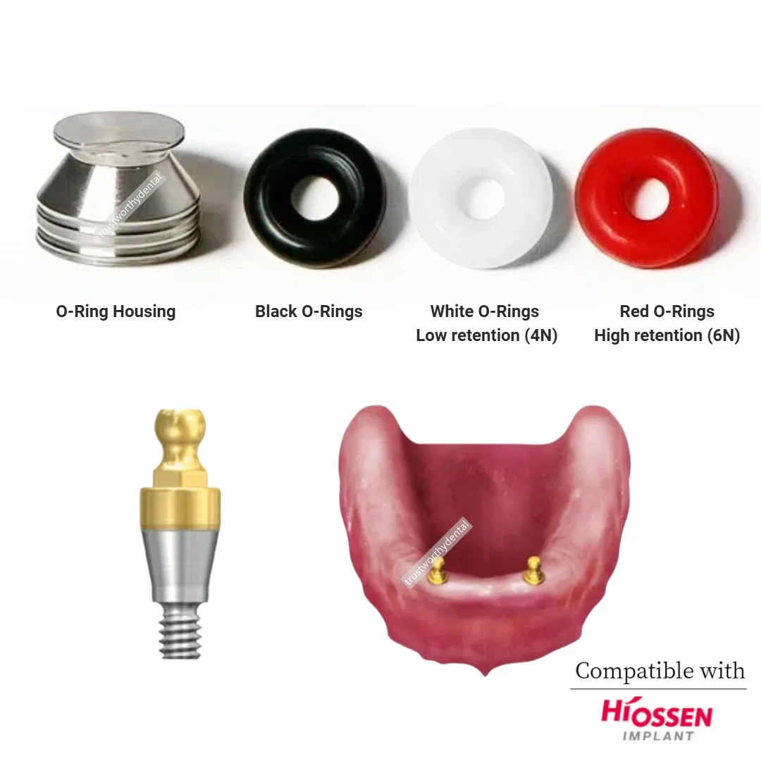 

Dental O-Ring Retainer Cap Set for Ball Abutment Retention Metal Housing Kit Oss Overdenture Attachments fit Compatible Hiossen