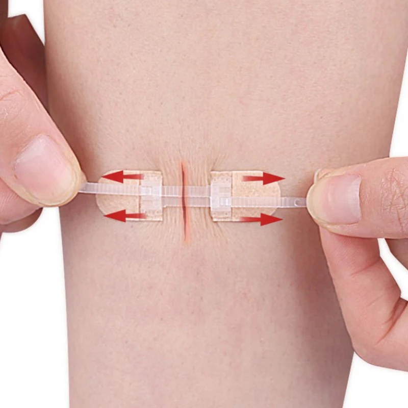 Patchs de fermeture à glissière pour les plaies, bandes élastiques respirantes, sans couture, sutures zippées, soins des plaies, bretelles, supports, 1 sac