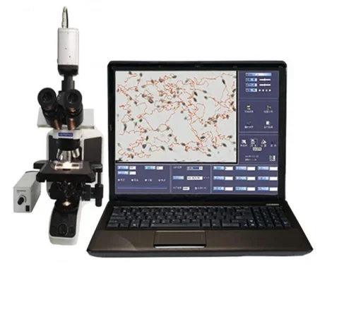 Portable and Trolley Type Semen Analysis Machine for Human and Animals