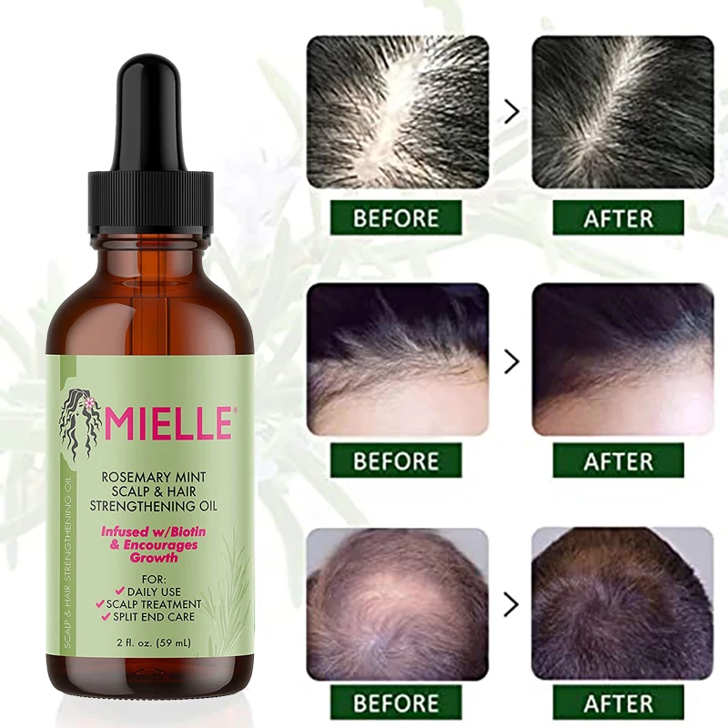 Aceite Esencial de Romero para el crecimiento del cabello, aceite de menta para fortalecer el cabello, tratamiento nutritivo para puntas secas y abiertas, aceite orgánico para el cabello