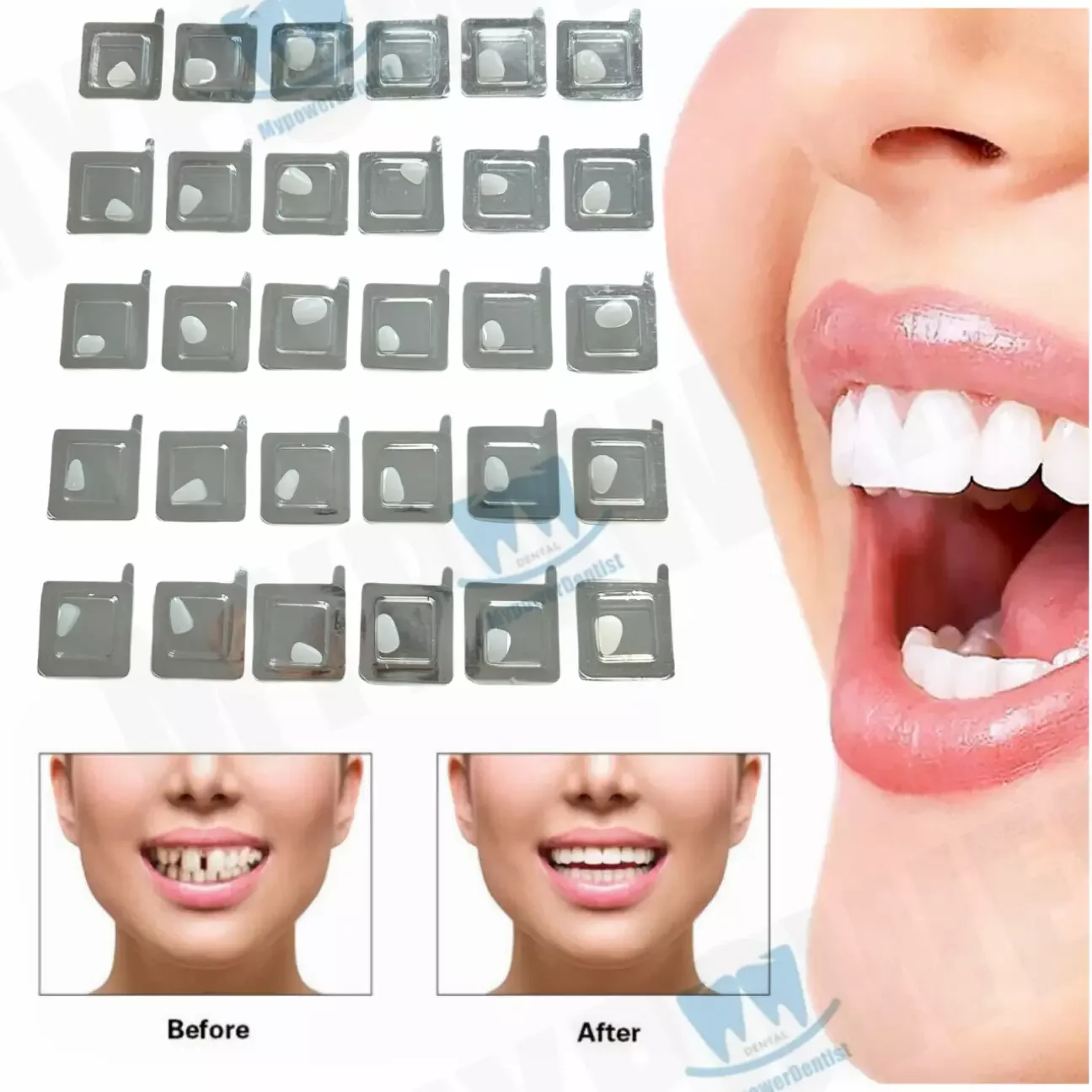 30Pcs Dental Teeth Veneer Whitening Porcelain Beauty Salon Thin Bright Ceramic