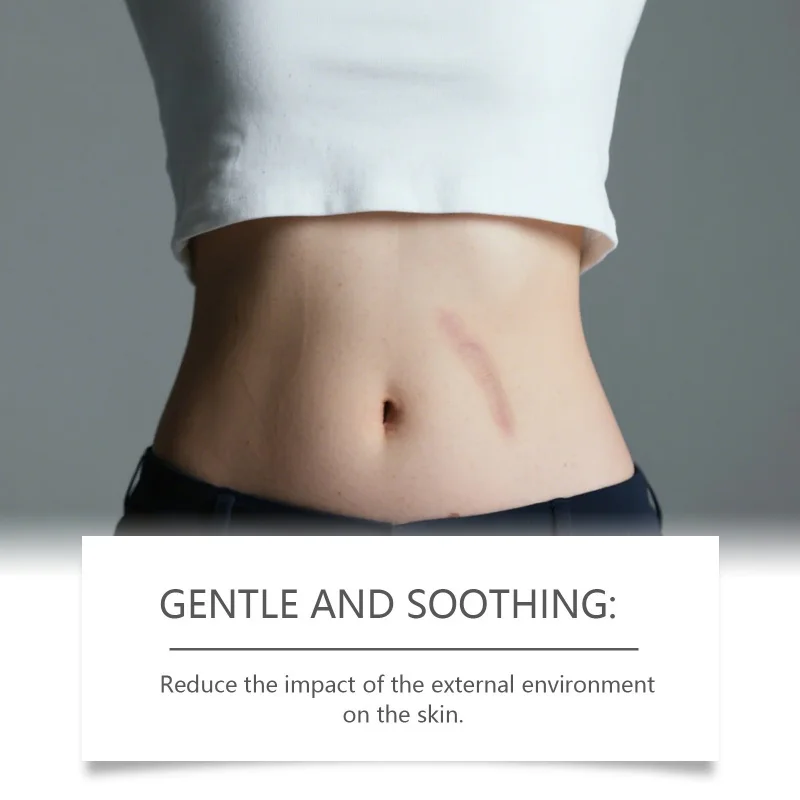 Zachte capsules voor dames met gummies Hydrateren Voeden Ondersteuning van de huid Reparatie Verbeteren de huid en versterken herstel tegen zonneschade