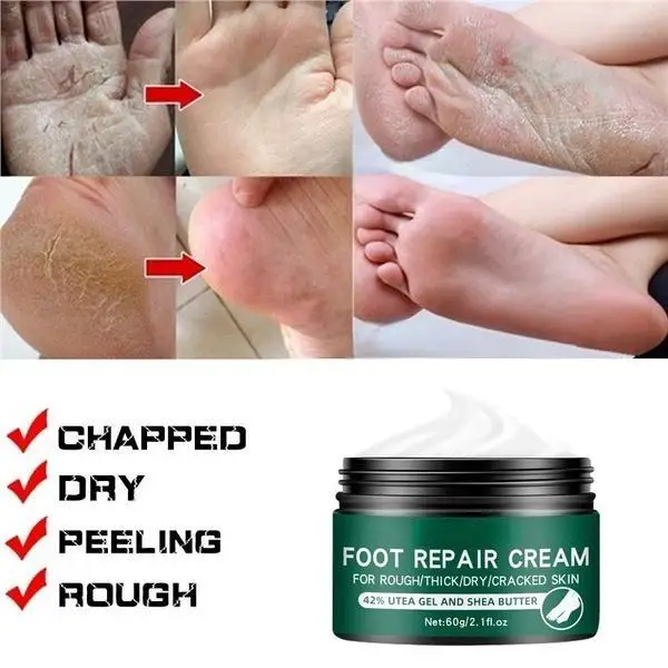 Newest Hand and Foot Skin Repairing Moisturizer Cream Anti-Chapping for Rough Dry and Cracked Chapped Feet Heel Repair Foot