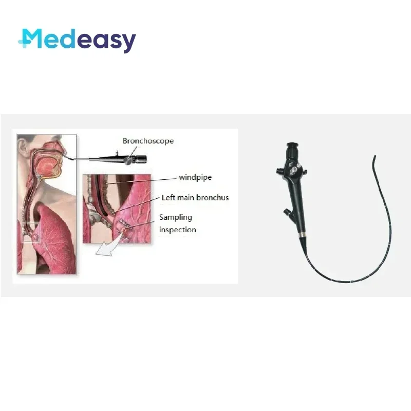 Medical Flexible Endoscope Fiber Bronchoscope/Nasopharyngoscope/Cystoscope/Ureteroscope