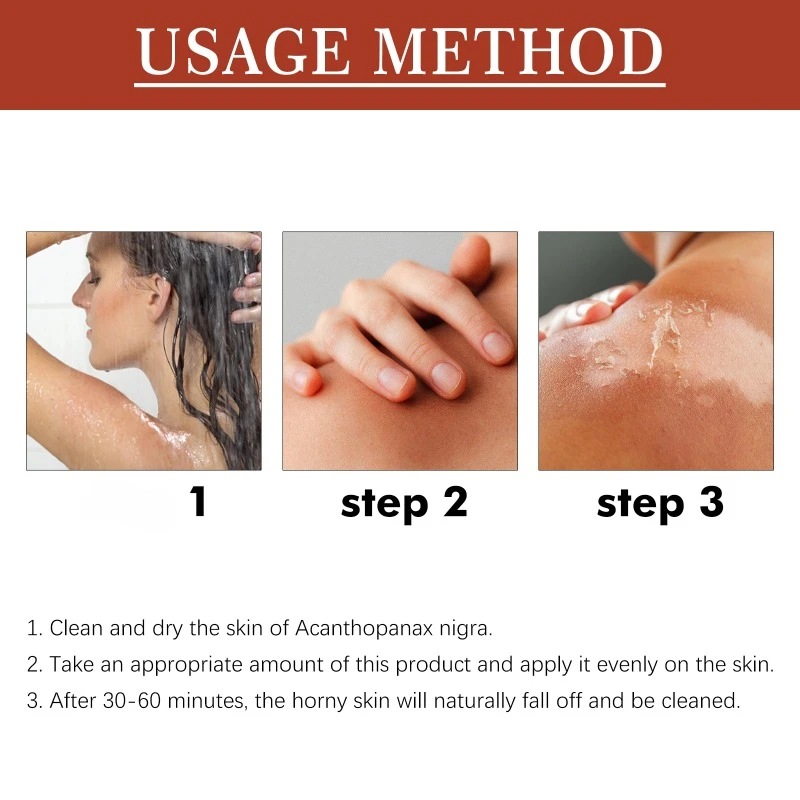 110ml Peeling Oil Elbow Knee Finger Black Yellow Oil For Skin Brightening whitening Moisturizing Remove Dead skin melanin