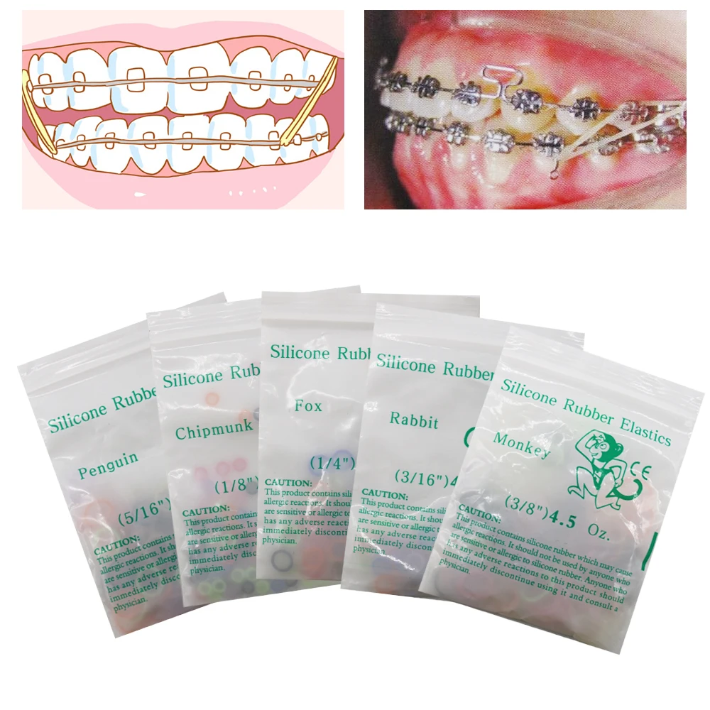 20Bags 2000Pcs 4.5OZ Colorful Orthodontic Rubber Bands Dental Elastic Band For Braces