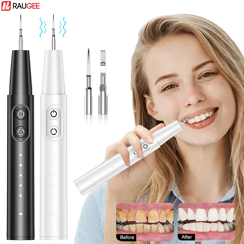 

Ultrasonic Dental Tartar Removal Ultrasound Teeth Cleaner Dental Scaler Stains Plaque Calculus Remover Teeth Tartar Eliminator