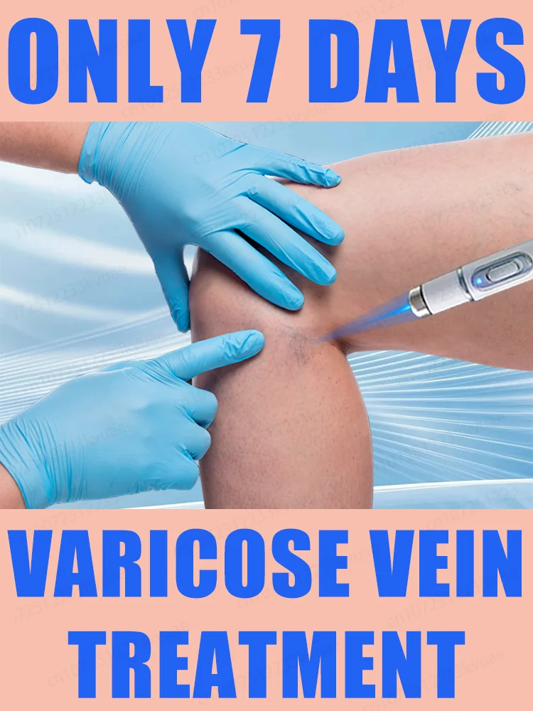 

2nd generation laser venous treatment pen, used to treat varicose veins