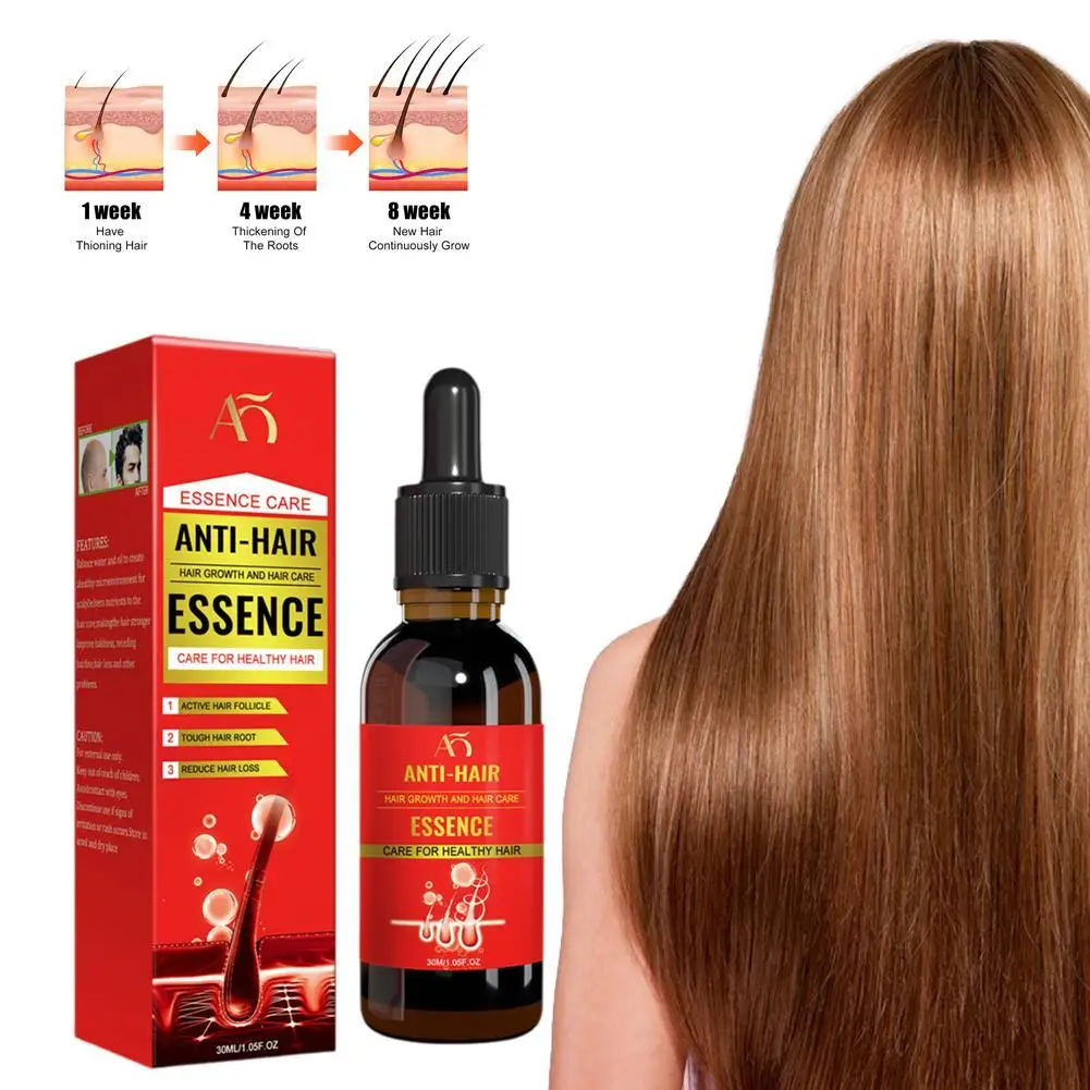 Fast Oil Effective Baldness Repair Hereditary Loss Postpartum Loss Seborrheic Hair Anti Loss