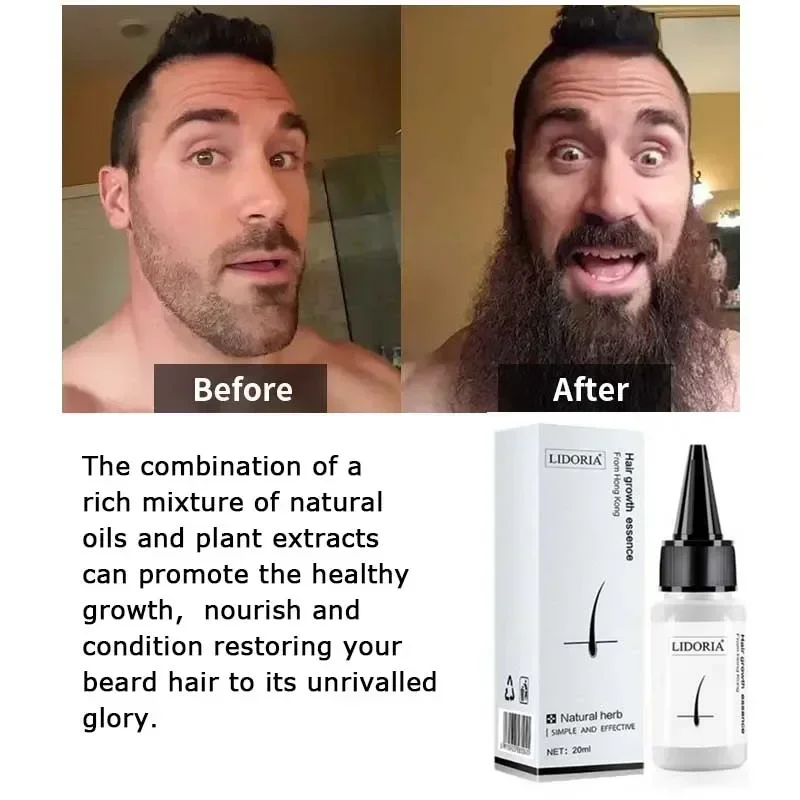 Fast Hair Growth Serum Beard Oil Axillary and Chest Hair Regrowth Fluid Longer Thicker Preventing alopecia Anti-Hair Loss