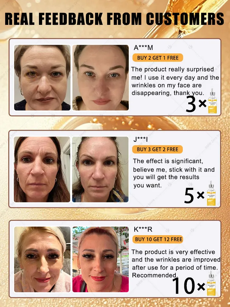 pour les rides, 20 ans plus jeunes