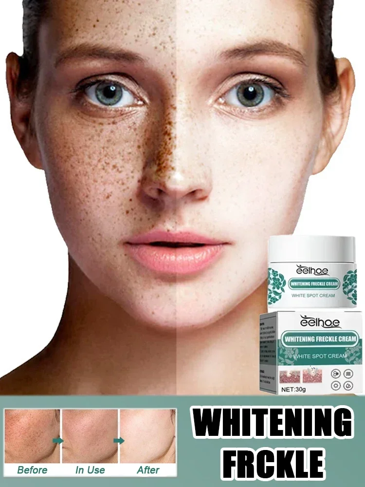 Whitening freckle removing Reduces Melanin Brightens Facial Lightens Dull Skin Fine Lines Facial Care