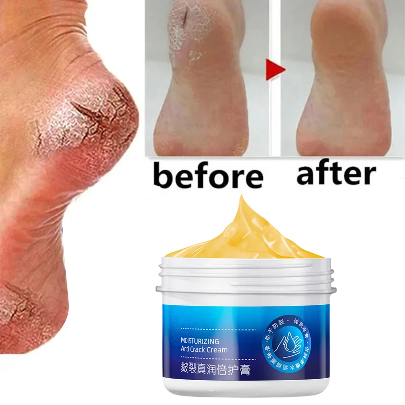 Anti-Drying Crack Hand Foot Care Cream Heel Cracked Repair Products Removal Dead Skin Moisturizing Whitening Nourish Skin Care