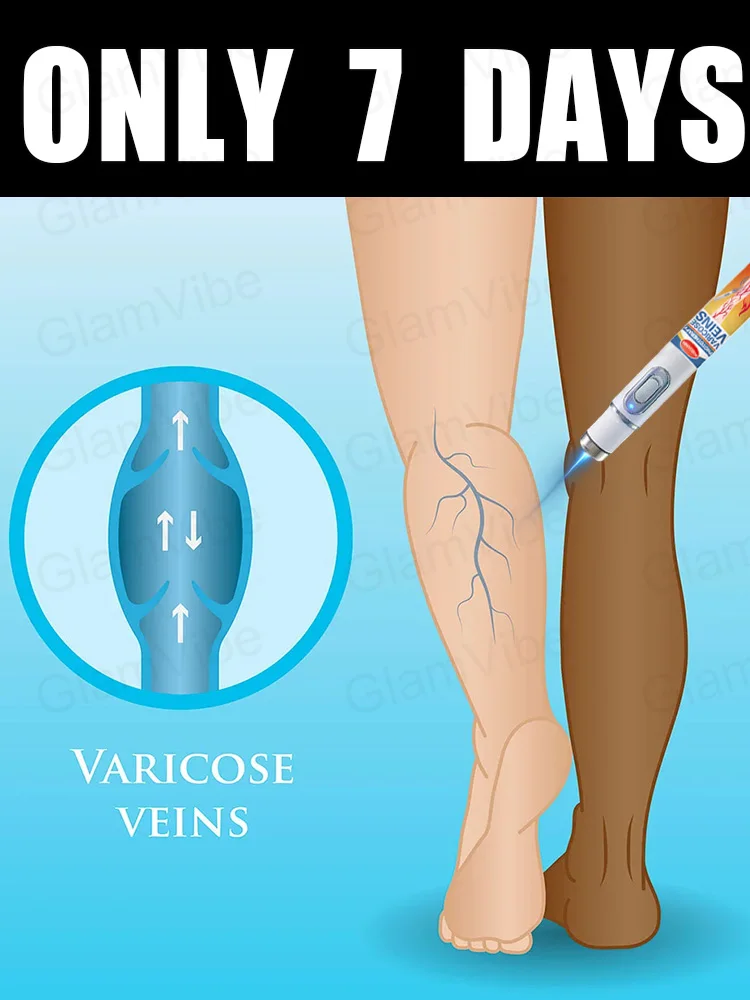 

blue light pen solve varicose veins, hot sale leg care tools