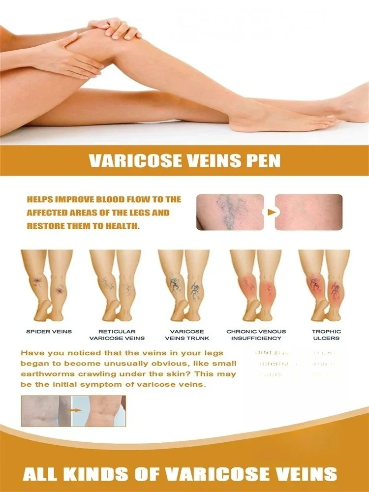 2025 Laser À Lumière Bleue | Améliore La Circulation Sanguine | Traitement Indolore Des Varices