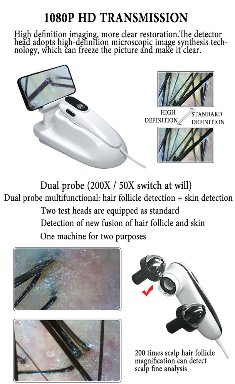 New Arrival Antera 3D Skin Analyzer, LED Scalp Micro Hydro Analyser, Professional Beauty Equipment Complete Accessories