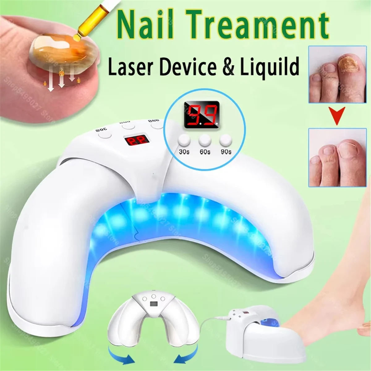BABQ Dispositivo de tratamiento láser para hongos en las uñas, tratamiento de hongos en las uñas, onicomicosis, elimina eficazmente la onicomicosis, crecen las uñas de los pies