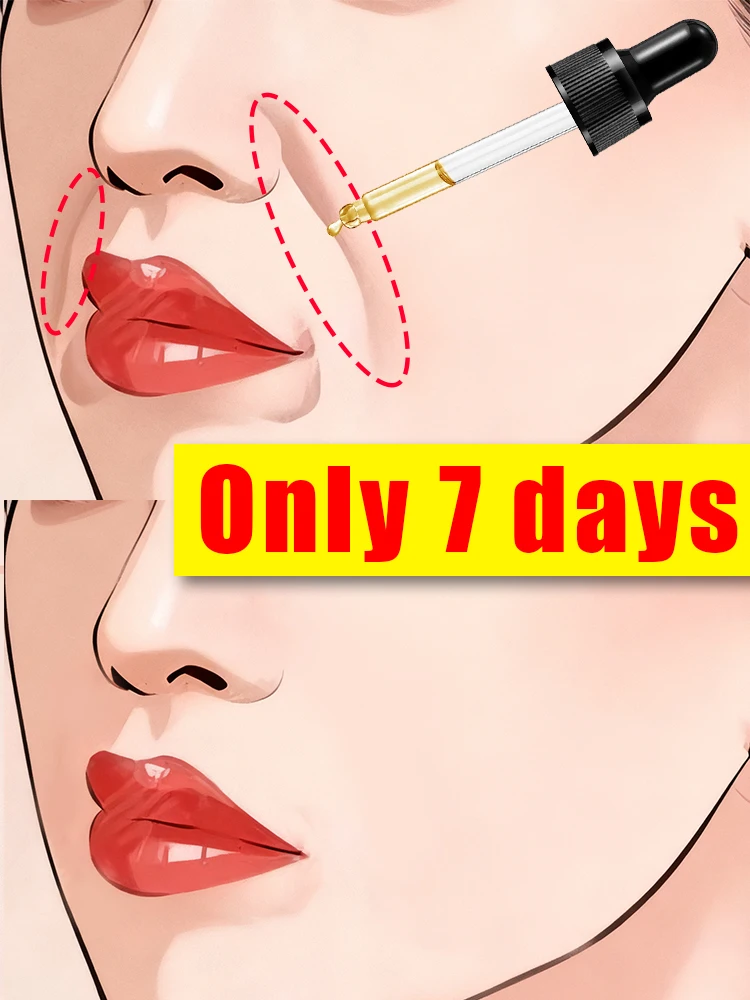 

Say goodbye to nasolabial folds in 7 days and look 20 years younger.