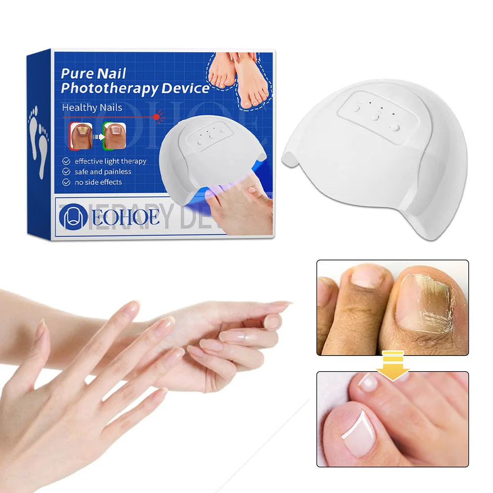 Nail Fungus Laser Treatment LED Light Device Toenail Fungus Treatment, Fungal Nail Treatment Device for Damaged Thick Toenails