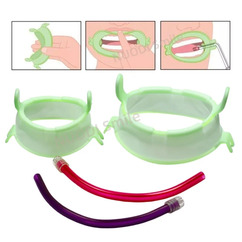 

Набор из 5 шт. стоматологических роторасширителей для губ и щек с отсосом, O-образные расширители для открытия рта, инструменты для отбеливания зубов, стоматологические принадлежности