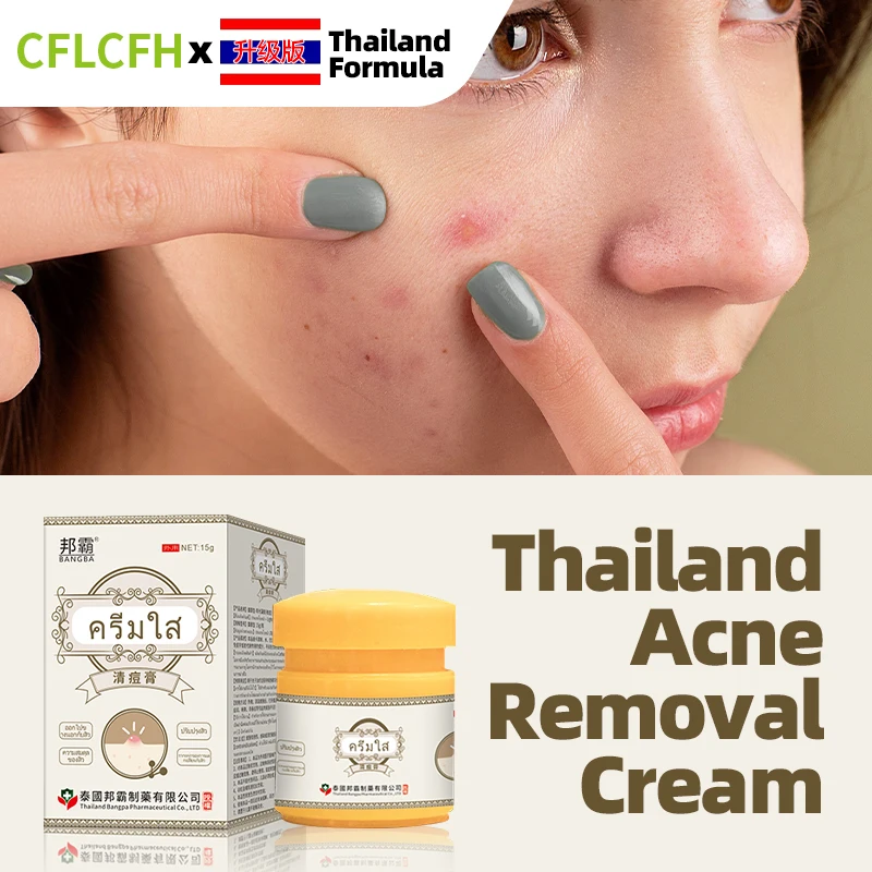 

Acne Treatment Cream Shrink Pores Blackhead Remover Pimple Anti Acne Marks Removal Ointment Whitening Face Care Thailand Formula