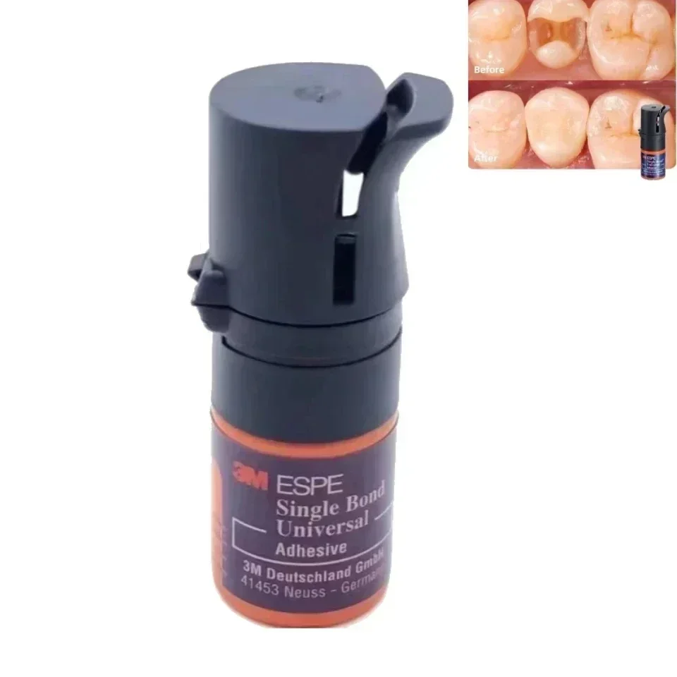 

Универсальный клей 3M ESPE с одним сцеплением | Световой стоматологический склеивающий агент объемом 5 мл | Скотчбонд 8-го поколения Etch-Iinse & Self-E