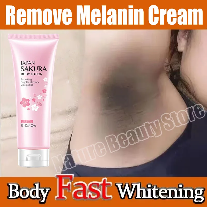 Nicotinamide Brightening Cream For Dark Skin Fast Lighten Thigh Inner Bleach Remove Melanin Private Parts Brighten Cream 120ml