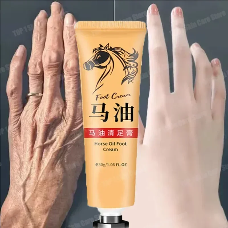 Creme de pele com óleo de cavalo, pomada anti-rachaduras, evita a pele seca, hidrata, protege os dedos dos pés e produtos de cuidados com a pele