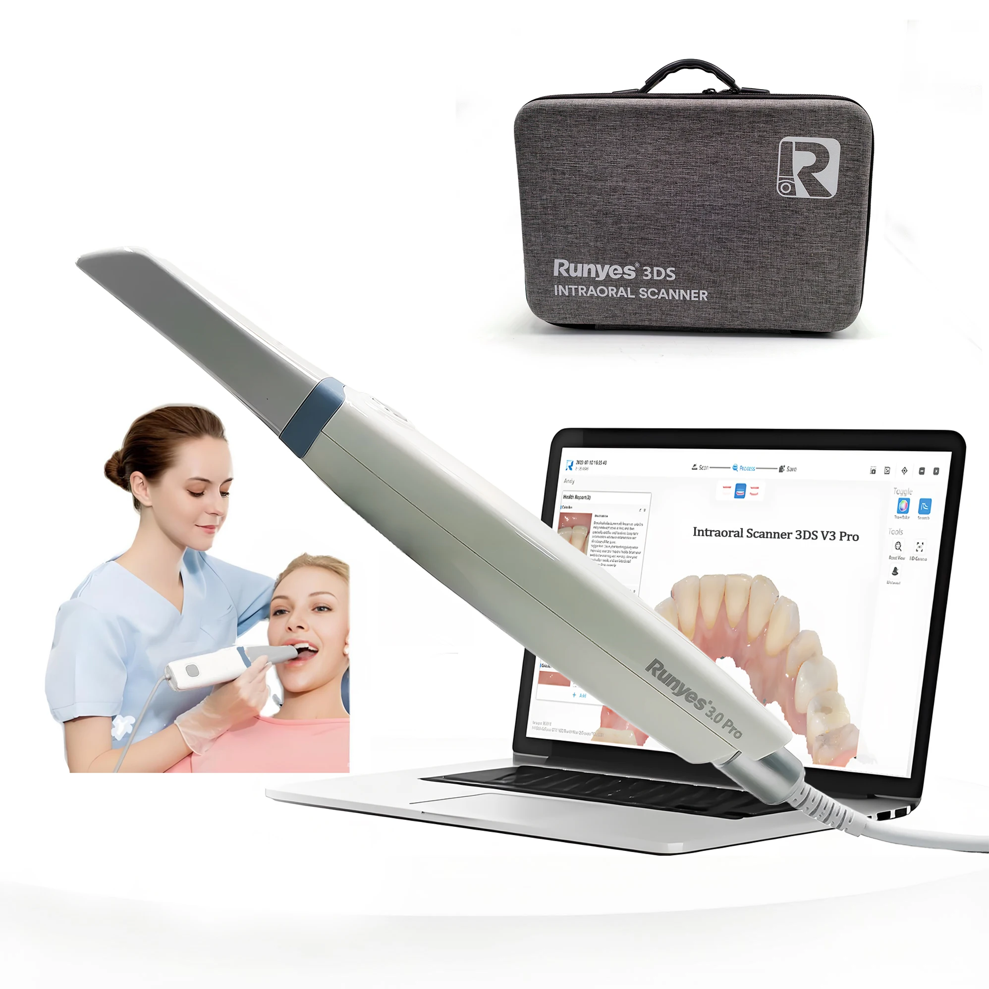 Intraoral Scanner, Dental Scanner Runyes 3DS V3 PRO TrueColor Imaging Accuracy 10μm 3D Dental Intraoral Scanner, Dental Equipmen