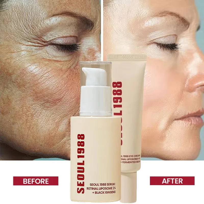 Seoul 1988 Retinol Ginseng Eye & Face Cream Serum Set Firming Moisturizing Diminish Lines Wrinkles Skin Care Essences