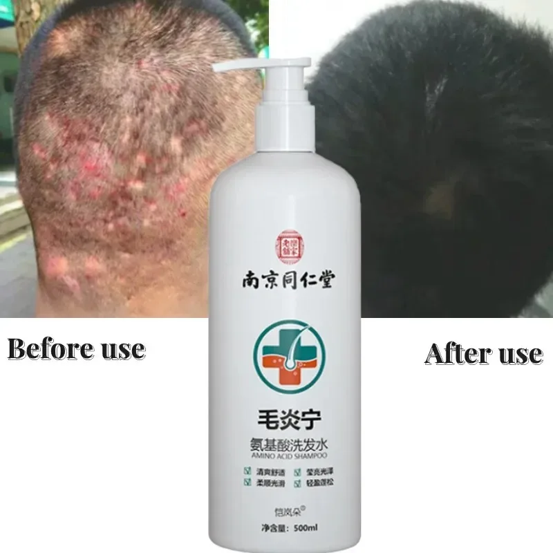 500ml Inflammation Amino Acid Ning Shampoo Dew Repair Hair Follicle Plant Mite Removal Hair Cream Damage Repair Improve Frizz