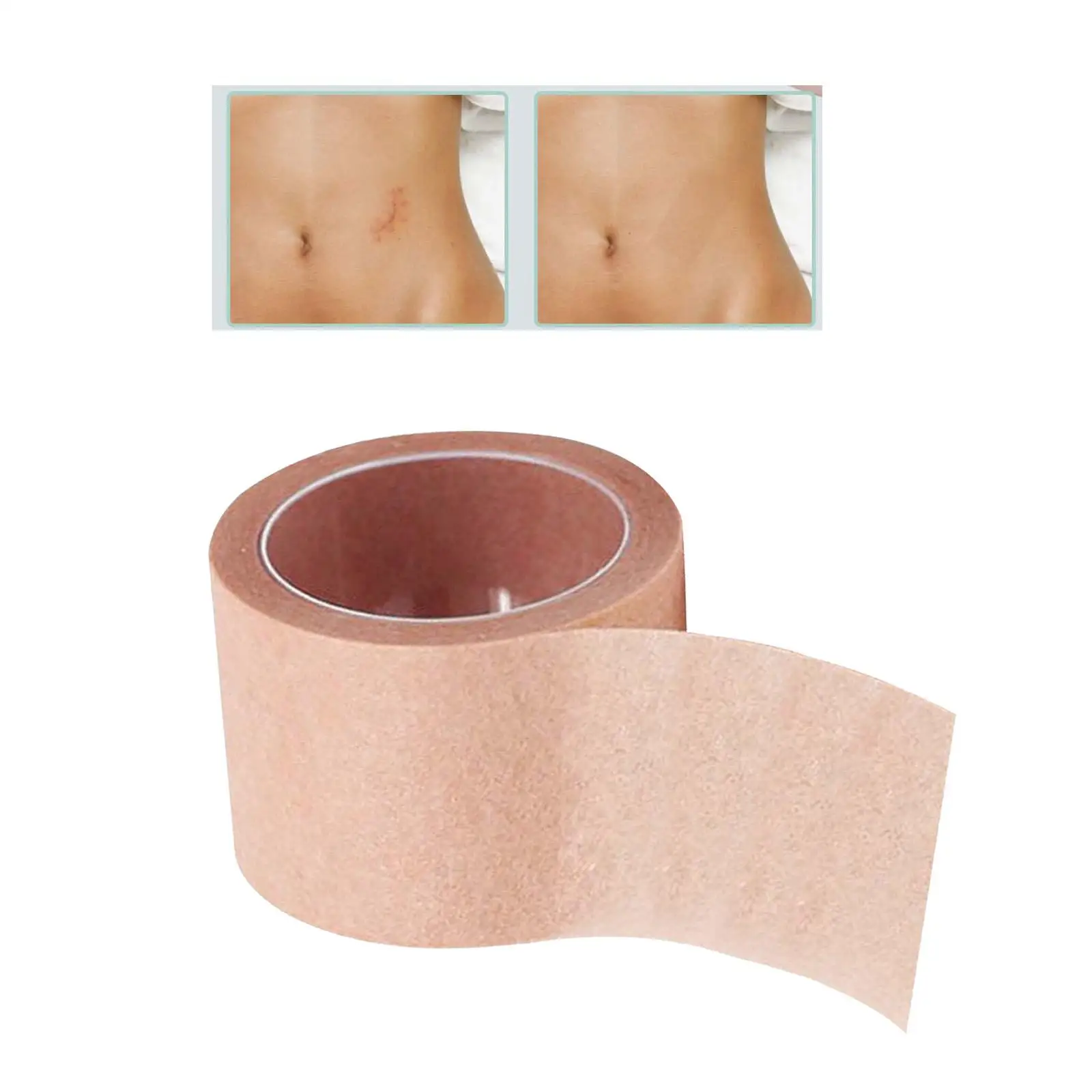 

Flaw Cover Tape Waterproof Patch 5M Length Concealer Tape Breathable Flaw Conceal Sticker